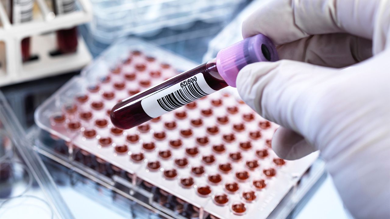 చుక్క రక్తంతో క్యాన్సర్ నిర్ధారణ.. క్యాన్సర్ స్పాట్ ఆవిష్కరించిన రిలయన్స్