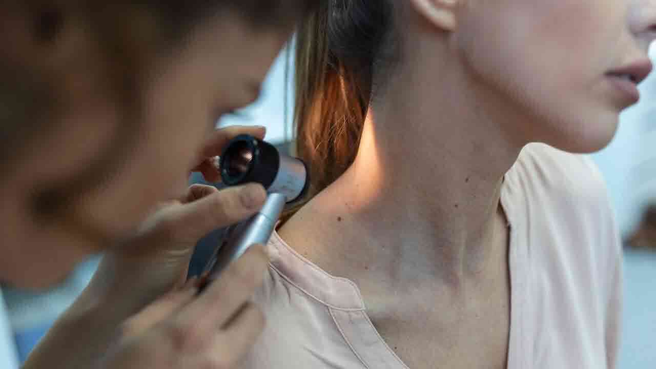Effects of Moles on Body | శరీరంపై పుట్టుమచ్చలు.. వాటి ఫలితాలు