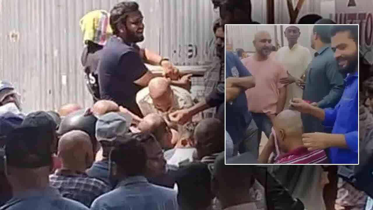 బట్ట తలపై జుట్టు వచ్చేలా చేస్తాం.. హైదరాబాద్‌లో కొత్త తరహా మోసం