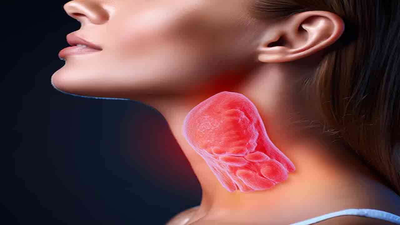 థైరాయిడ్ సమస్యను శాశ్వతంగా దూరం చేసే ఇంటి చిట్కాలు