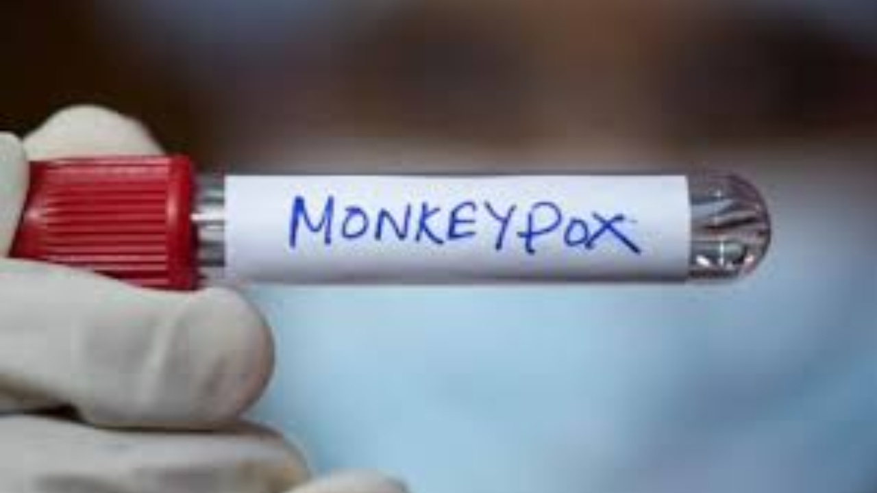 Monkeypox : భారత్‌కు పెను ముప్పు..మంకీపాక్స్‌ను ఎదుర్కోవటానికి ఎయిమ్స్ మార్గదర్శకాలు ఇవే 