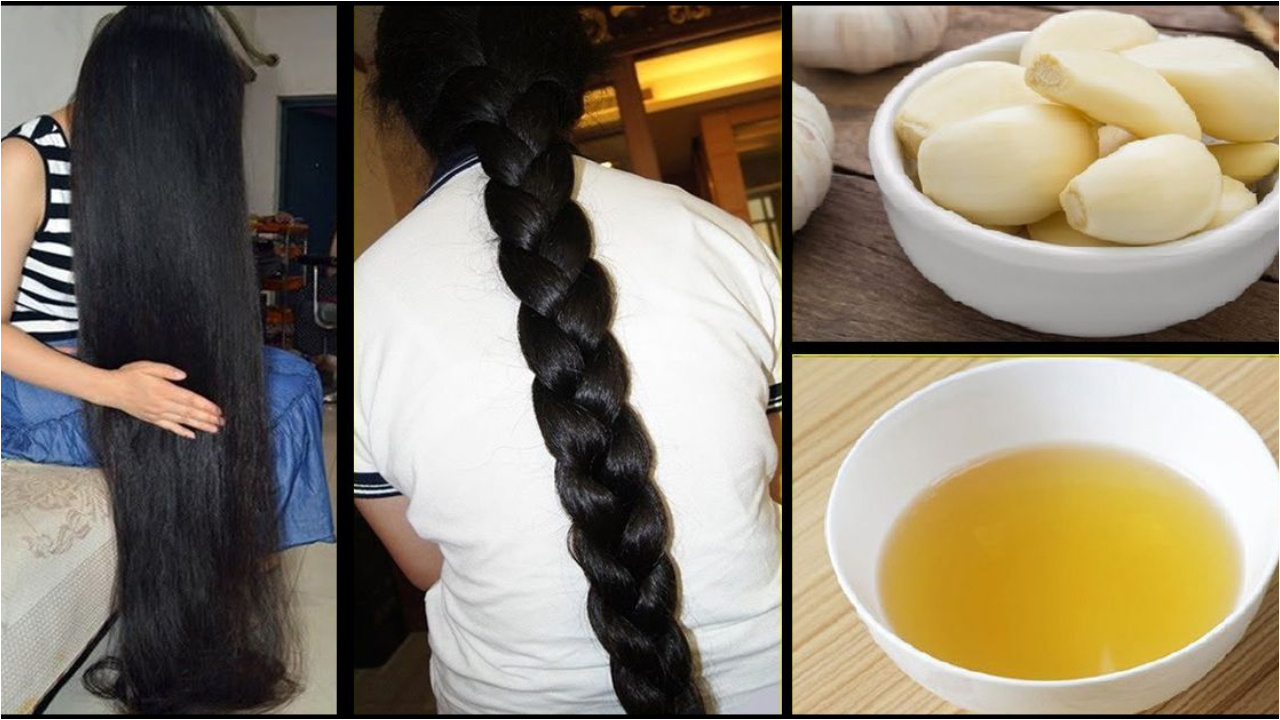 Hair Care:  రెండు వెల్లుల్లి రెబ్బలను ఇలా వాడితే ..మీ వెంట్రుకలు ఊడిపోకుండా బలంగా మారడం ఖాయం