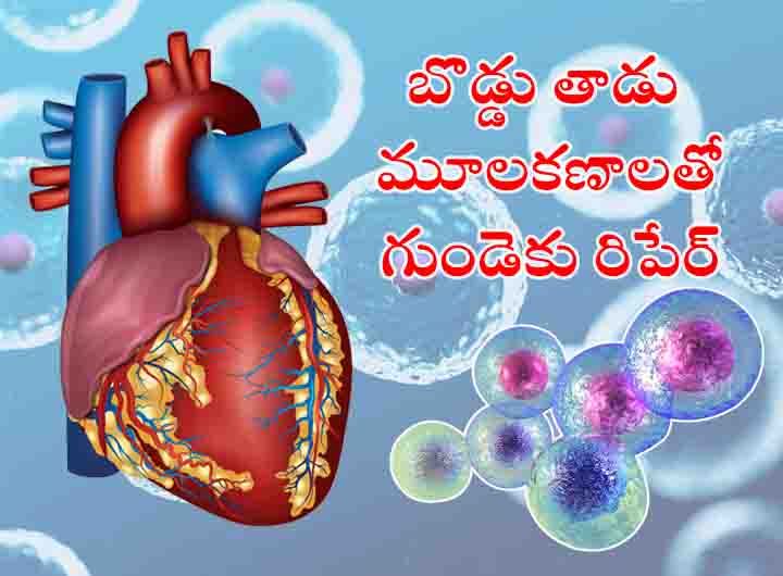 Heart Problems : శాస్త్రవేత్తల అద్భుత సృష్టి.. బొడ్డు తాడు నుంచి తీసిన మూల కణాలతో గుండె రిపేర్