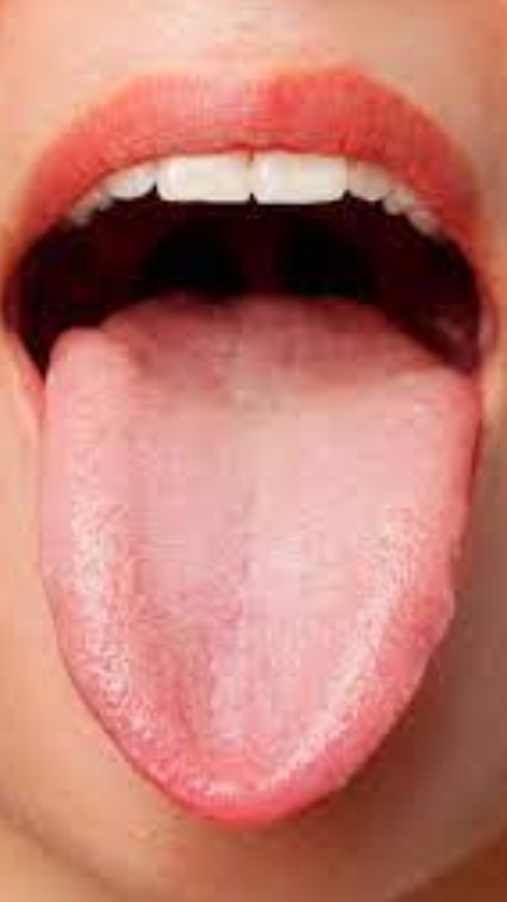 నాలుక రంగు చెప్తుంది.. మీరు ఆరోగ్యంగా ఉన్నారా?